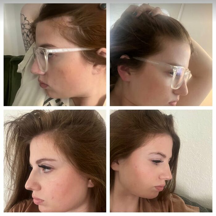 Mielle Organics Rosemary Mint Scalp & Hair Strengthening Oil  59 Ml - Image 2