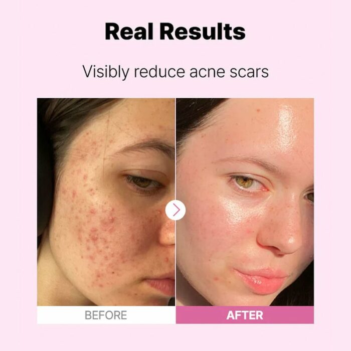 ⁦COSRX The Niacinamide 15 Serum - 20ml⁩ - الصورة ⁦3⁩