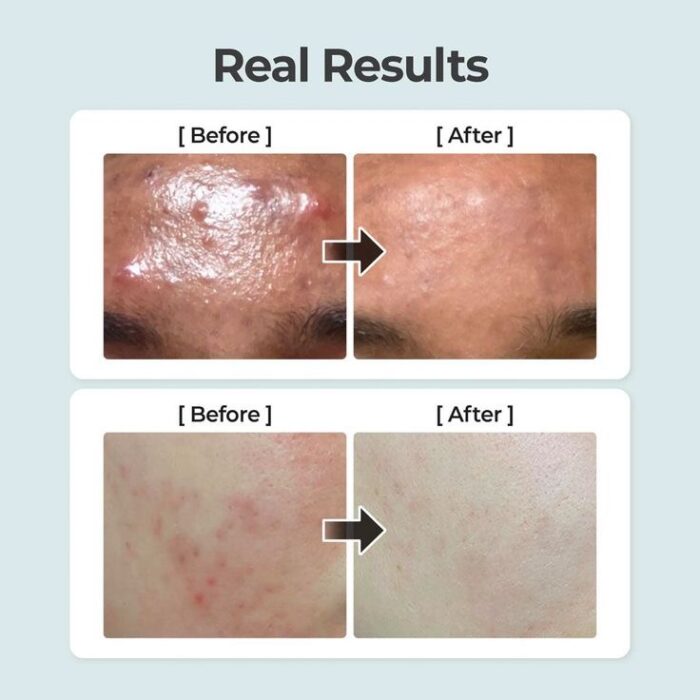 numbuzin No. 1 Pure-Full Calming Herb Toner - Image 3