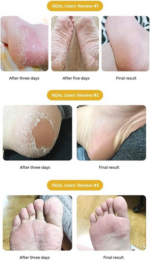 Purederm Exfoliating Foot Beauty Mask, Regular, 1 Pair, 20 ml - Image 5