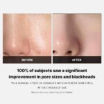 ⁦Medicube Zero Pore Pads 2.0  155 g (70 pads )⁩ - الصورة ⁦5⁩