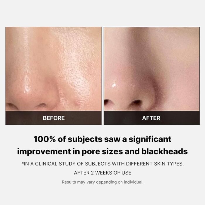 ⁦Medicube Zero Pore Pads 2.0  155 g (70 pads )⁩ - الصورة ⁦5⁩