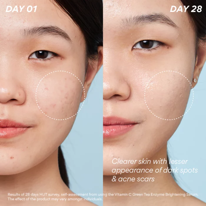 Innisfree Vitamin C Green Tea Enzyme Brightening Serum 30ml - Image 2