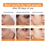 Innisfree Vitamin C Green Tea Enzyme Brightening Serum 30ml - Image 4