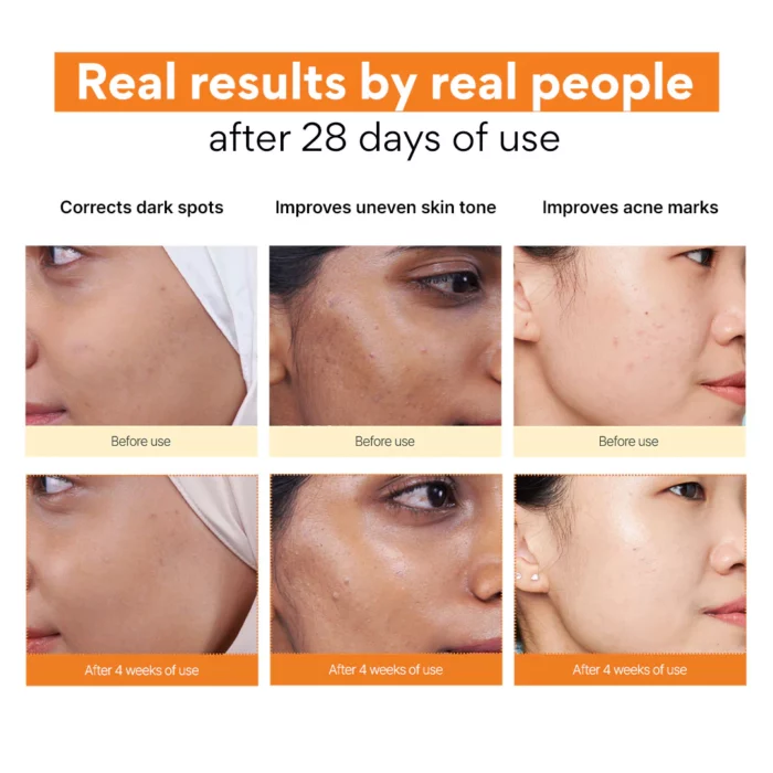 Innisfree Vitamin C Green Tea Enzyme Brightening Serum 30ml - Image 4