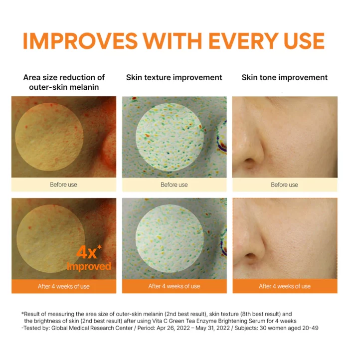 Innisfree Vitamin C Green Tea Enzyme Brightening Serum 30ml - Image 5