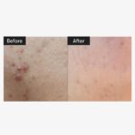 VT Reedle Shot 100 - Image 2