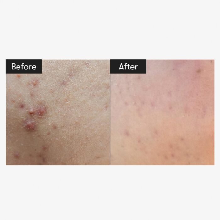 VT Reedle Shot 100 - Image 2