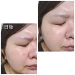 VT Reedle Shot 100 - Image 3