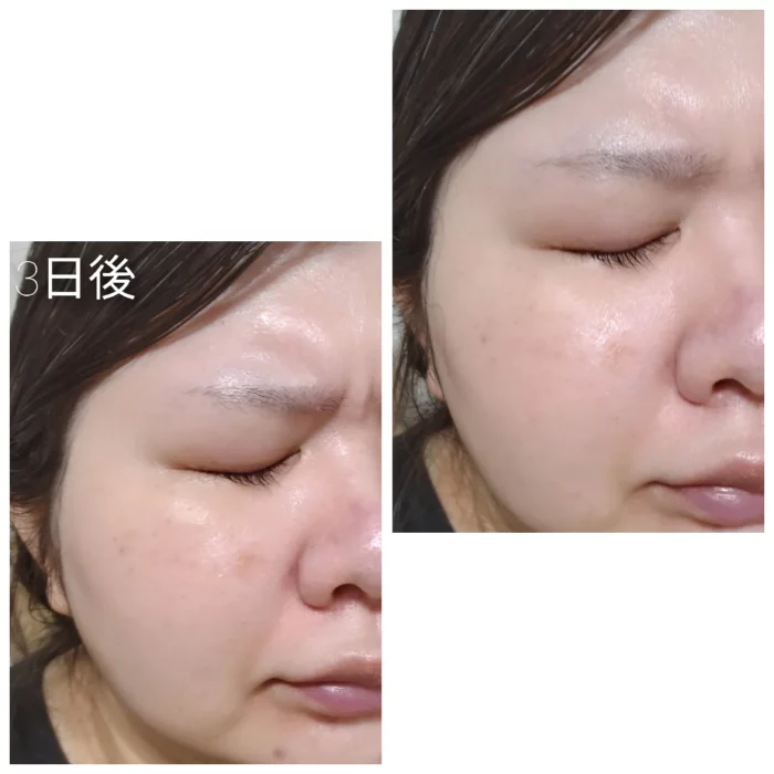 VT Reedle Shot 100 - Image 3