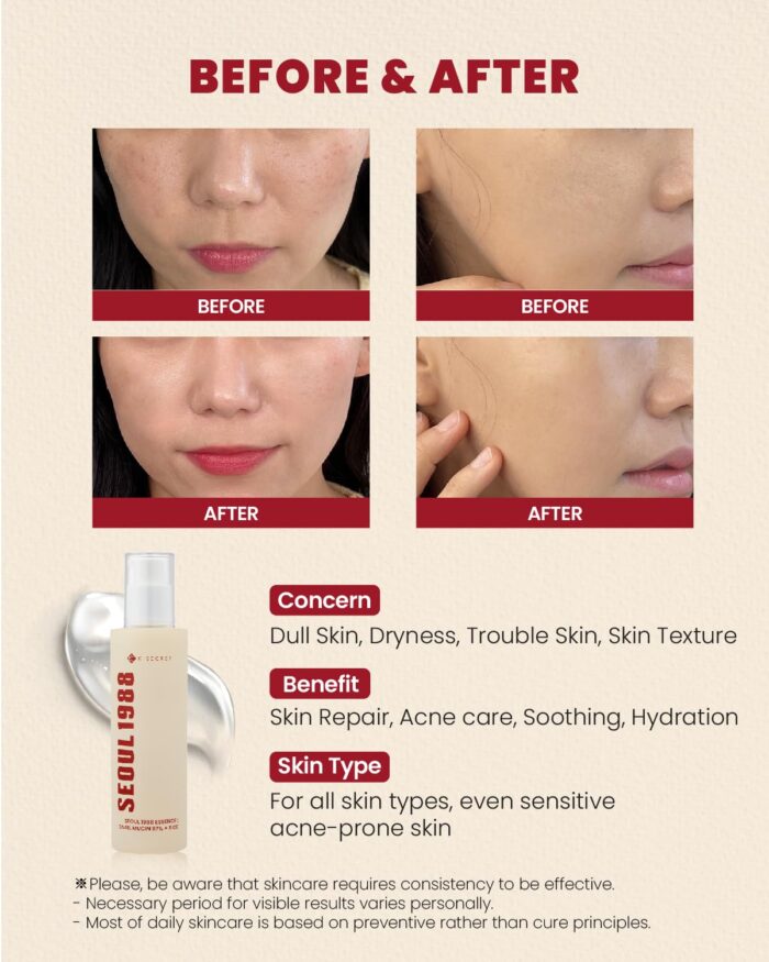 KSECRET SEOUL 1988 Essence : Snail Mucin 97% + Rice - Image 3