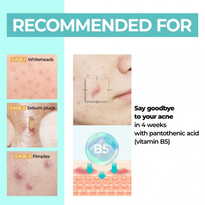 numbuzin No.1 Pantothenic B5 Active Soothing Cream - Image 2