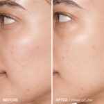 AXIS - Y  PHA Resurfacing Glow Peel - Image 3