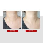 MEDI-PEEL Naite Thread Neck Cream 100 ML - Image 6