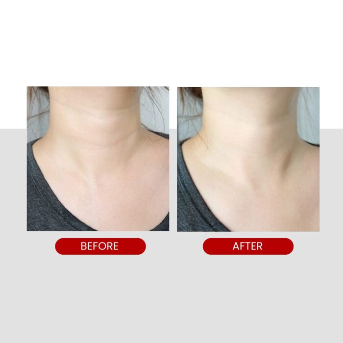 MEDI-PEEL Naite Thread Neck Cream 100 ML - Image 6