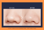 A'PIEU Goblin Blackhead 3-Step Nose Pack - Image 3