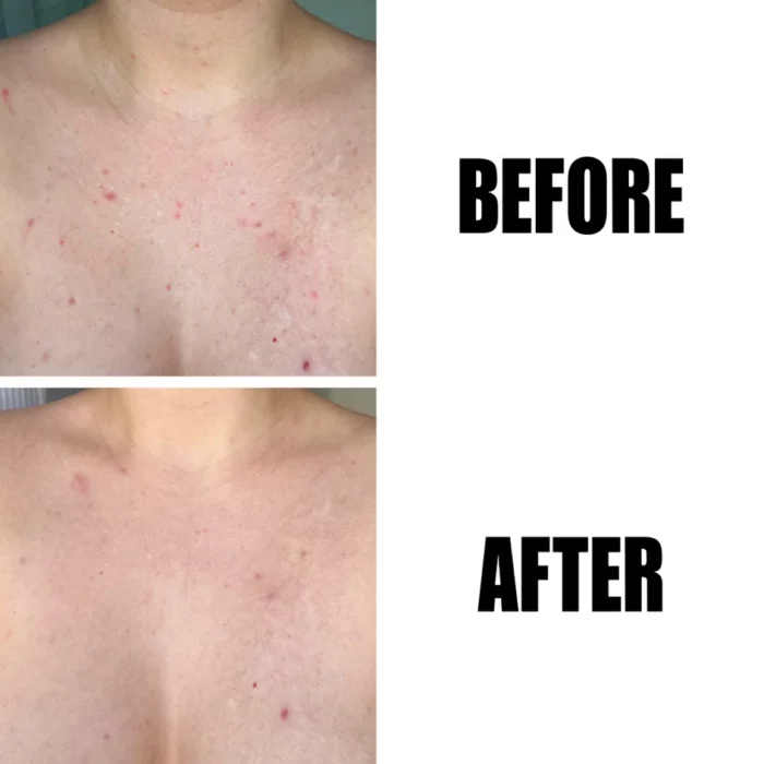 The INKEY List Glycolic Acid Exfoliating Body Stick 45g - Image 3