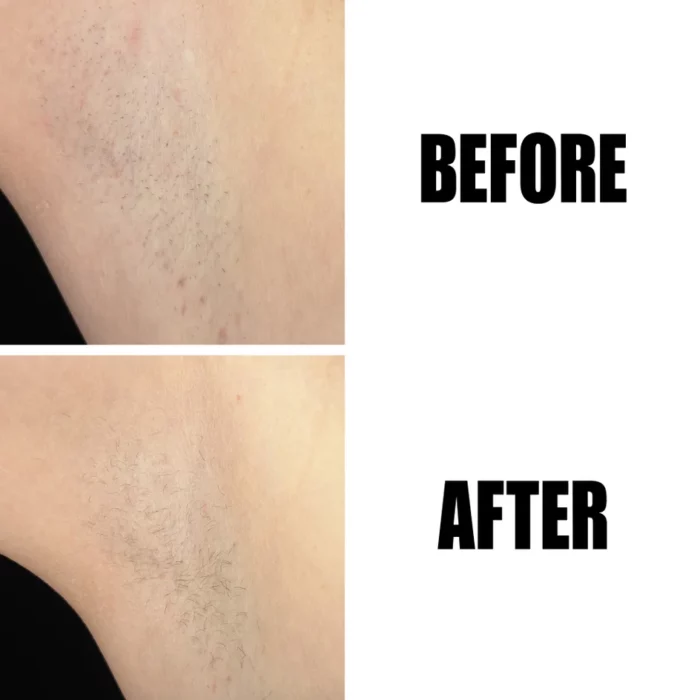 The INKEY List Glycolic Acid Exfoliating Body Stick 45g - Image 4