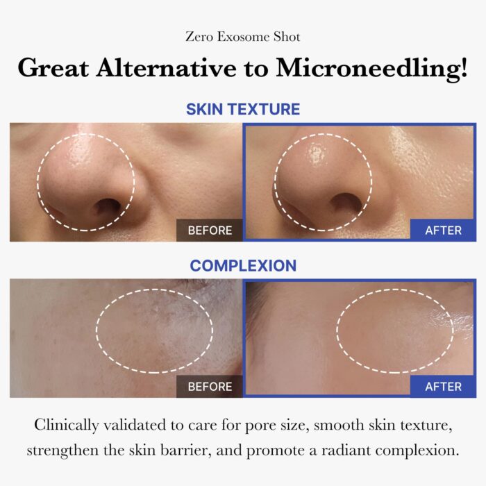 MEDICUBE One-Day Exosome Shot Pore Ampoule 2000 30ml - Image 2