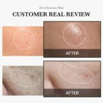 MEDICUBE One-Day Exosome Shot Pore Ampoule 2000 30ml - Image 5