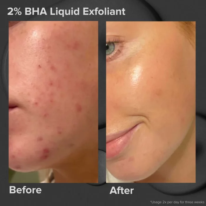 Paula's Choice SKIN PERFECTING 2% BHA Liquid Exfoliant 110 ML - Image 3