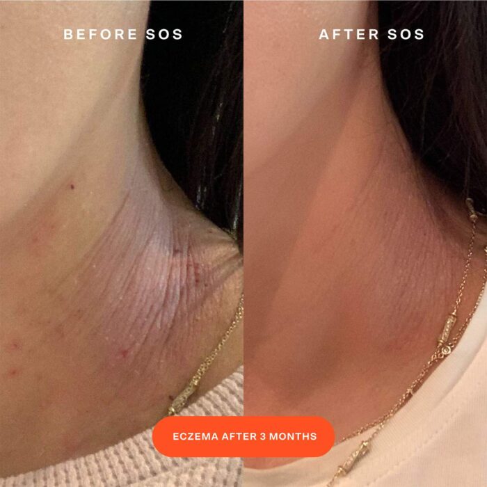 ⁦Tower 28 Beauty SOS Daily Rescue Facial Spray with Hypochlorous Acid 120 ML⁩ - الصورة ⁦5⁩