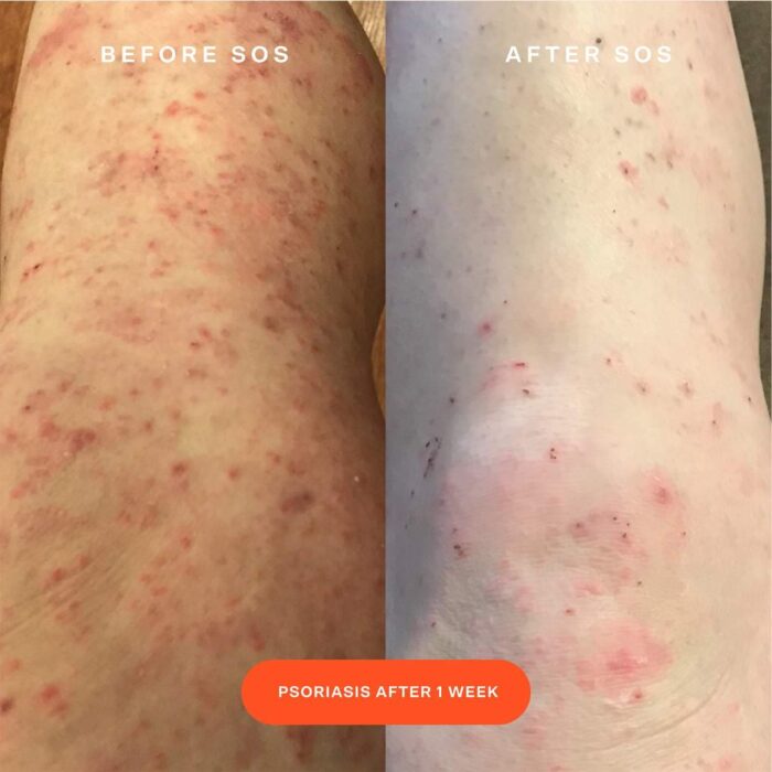 ⁦Tower 28 Beauty SOS Daily Rescue Facial Spray with Hypochlorous Acid 120 ML⁩ - الصورة ⁦6⁩