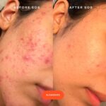 ⁦Tower 28 Beauty SOS Daily Rescue Facial Spray with Hypochlorous Acid 120 ML⁩ - الصورة ⁦3⁩