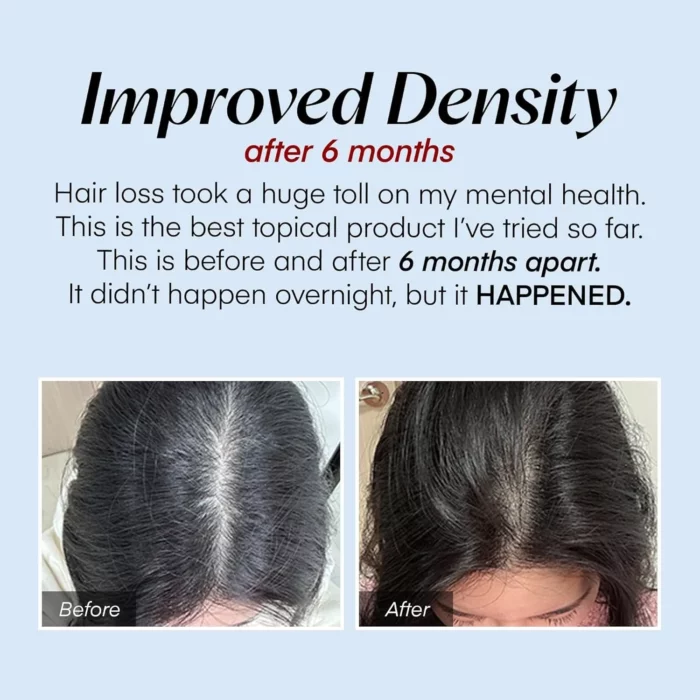 Seapuri Scalpy Hair Serum-Scalp Health & Hair Growth 20ml - Image 3