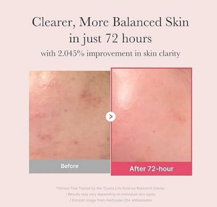 medicube TXA Niacinamaide 15 Serum [30ml] - Image 5