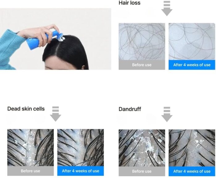 ⁦Seapuri  Scalpy Bubble Tonic - 100 ml⁩ - الصورة ⁦2⁩