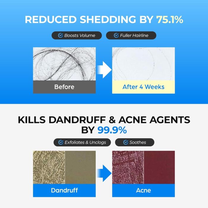 ⁦Seapuri  Scalpy Bubble Tonic - 100 ml⁩ - الصورة ⁦4⁩