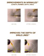 SKIN 1004 - Madagascar Centella Probio-Cica Bakuchiol Eye Cream Twin Pack Set - Image 4