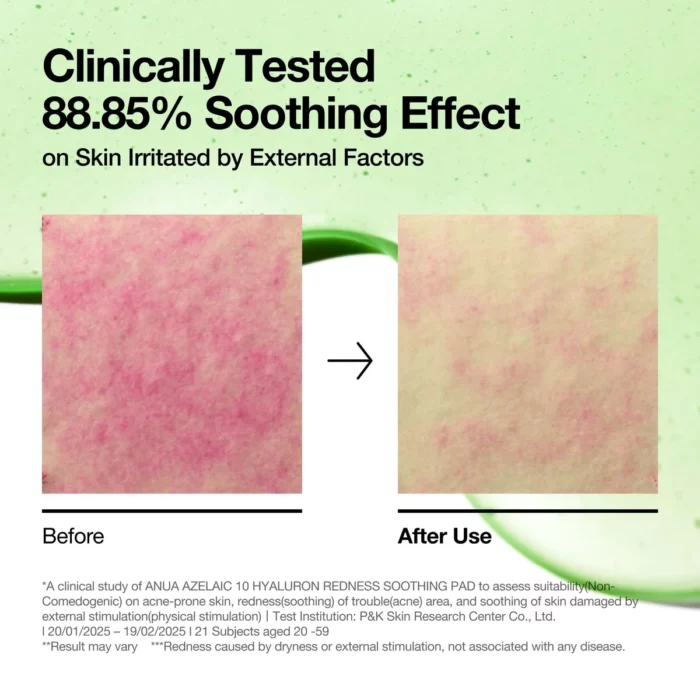 Anua Azelaic 10 Hyaluron Redness Soothing Pad - 90 pads - Image 2
