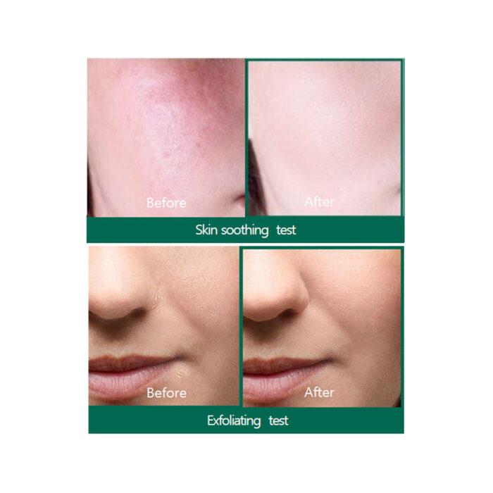 SOME BY MI - AHA, BHA, PHA 30 Days Miracle Serum 50ml - Image 4