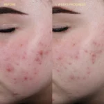 BYOMA Blemish Redness Relief Soothing Toner 100ml - Image 6