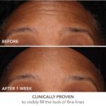 Dr Dennis Gross Skincare DermInfusions Fill and Repair Serum 7Ml - Image 3