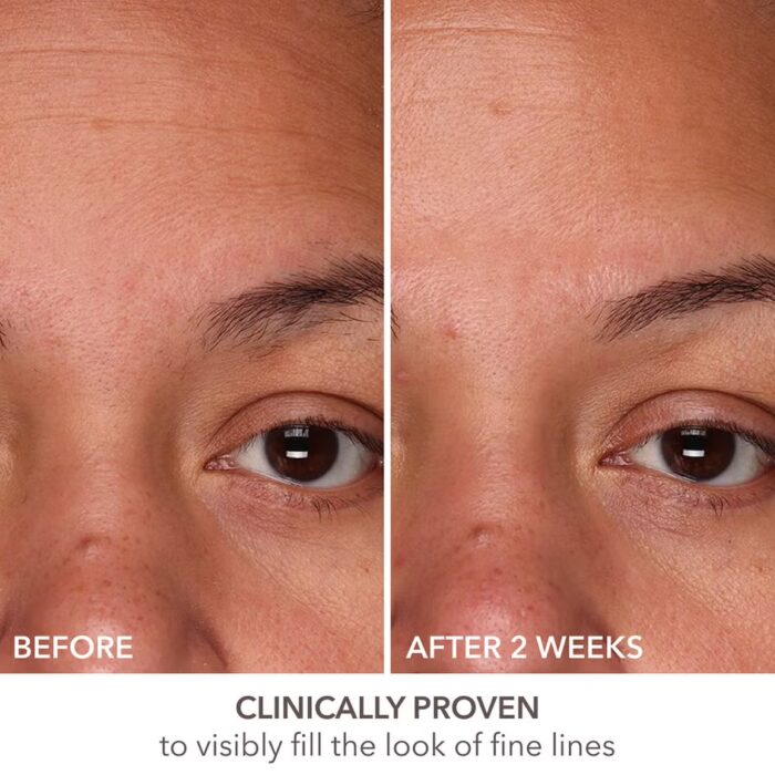 Dr Dennis Gross Skincare DermInfusions Fill and Repair Serum 7Ml - Image 4