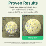 centellian24 madeca powder tea tree ac 6g [6g] - Image 3