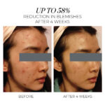 Oskia Violet Water Hydra-Gel Clarifying Daily Moisturiser 15ml - Image 3