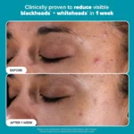 Paula's Choice  Skin Perfecting 2% BHA Exfoliating Toner for Clear Skin 30 ML - Image 4