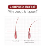 kundal head spa & scalp care scalp tonic 100ml - Image 2