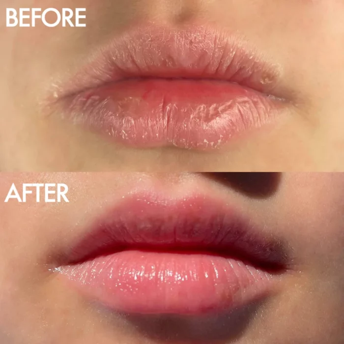 Lanolips The Original 101 Ointment - 15 g - Image 3