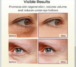 Dr.Melaxin Cemenrete Calcium Volume Multi Balm - 9g - Image 4