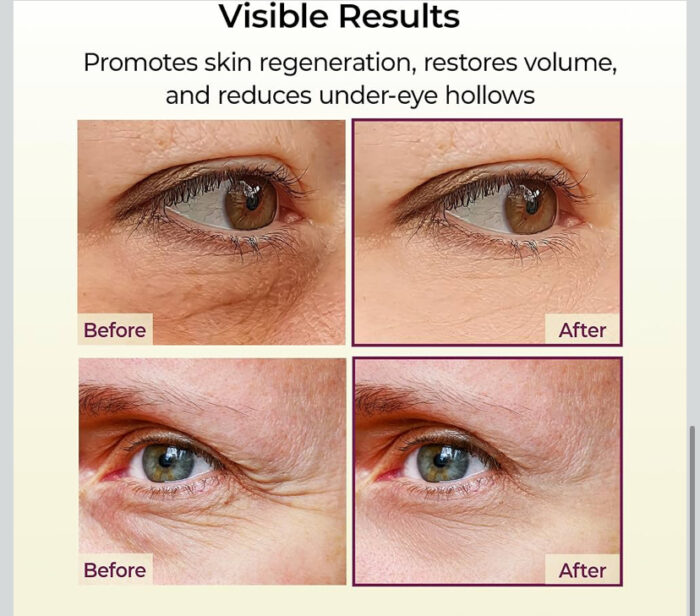 Dr.Melaxin Cemenrete Calcium Volume Multi Balm - 9g - Image 4