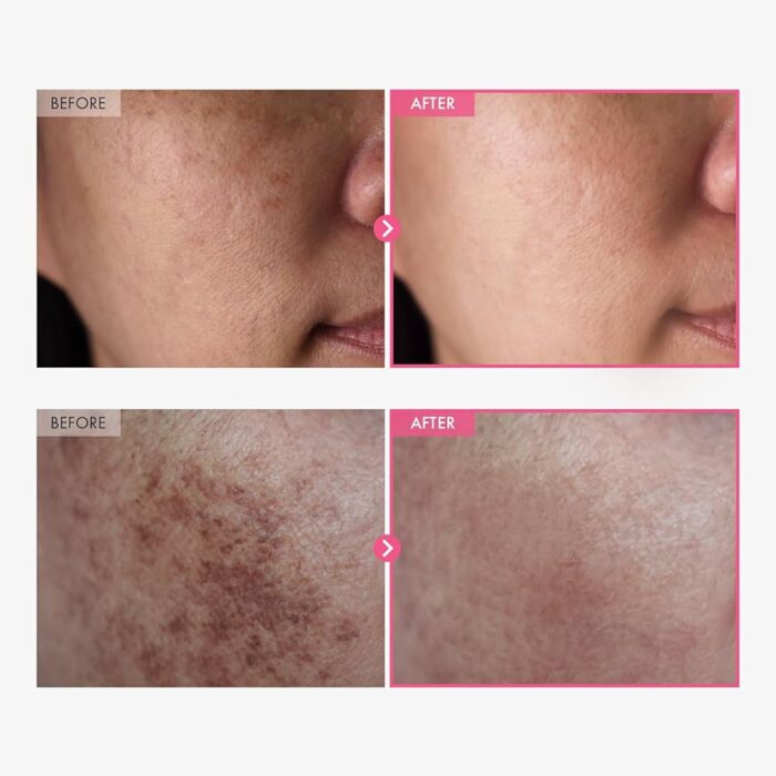 TOSOWOONG Arbutin 5% Whitening Cream - 50 g - Image 2