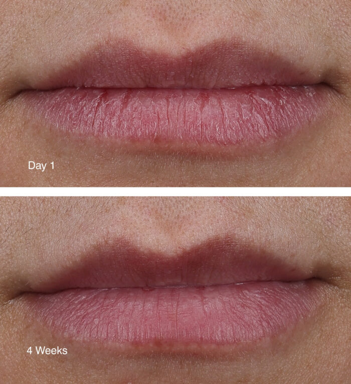 ⁦Rhode peptide lip treatment caramelized banana⁩ - الصورة ⁦6⁩