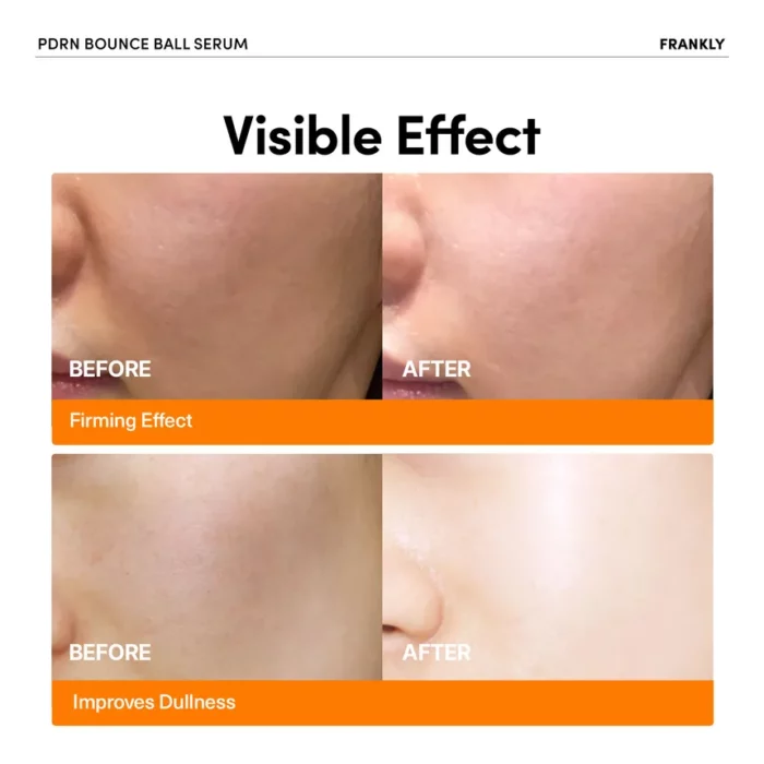 FRANKLY PDRN Bounce Ball Serum 30ML - Image 2