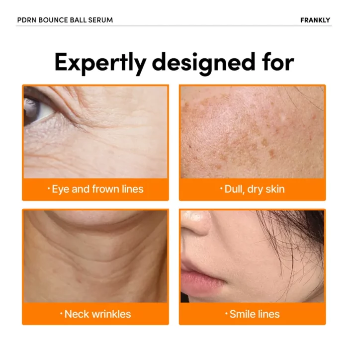 FRANKLY PDRN Bounce Ball Serum 30ML - Image 6