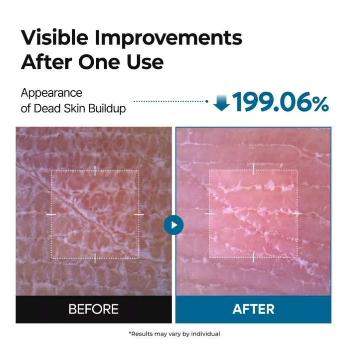 Dr.Melaxin Peel Shot Exfoliating TX-Spray 200 ML - Image 3